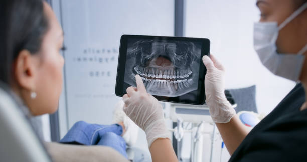 Licensed Tooth Extraction service in Santa Cruz, CA - Smile Center Dentistry